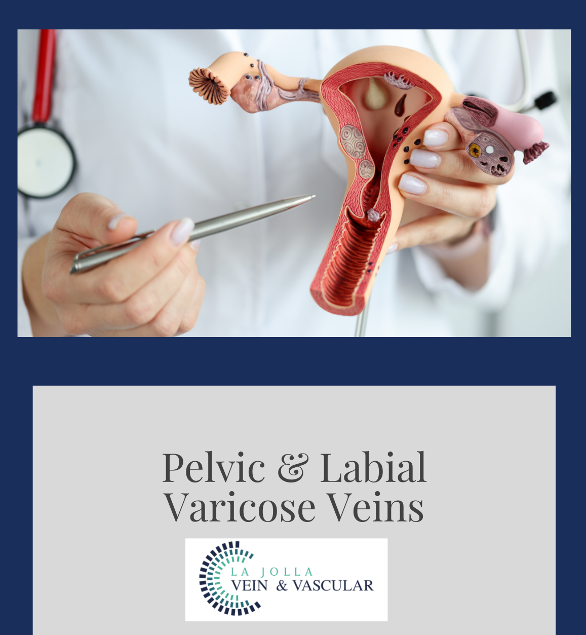Interventional Radiology Group - Pelvic Vein Embolization is an effective  treatment for Pelvic Congestion Syndrome in Women! Pelvic congestion  syndrome occurs when pelvic veins become swollen and painful due to low  blood