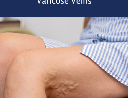 Patient Transformation: Varicose Veins