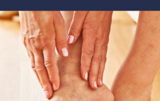 varicose vein treatment