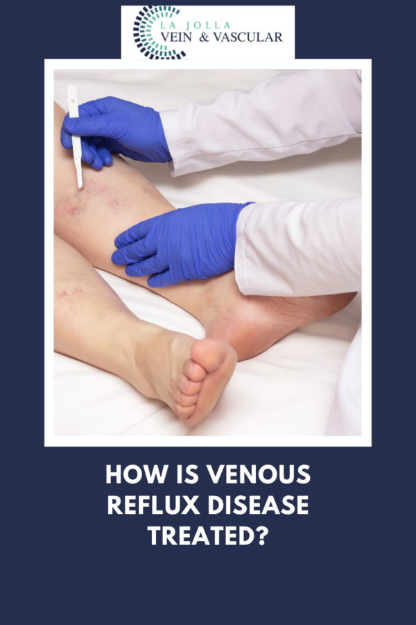 Vein & Vascular Treatment | Venous Reflux Disease Treated