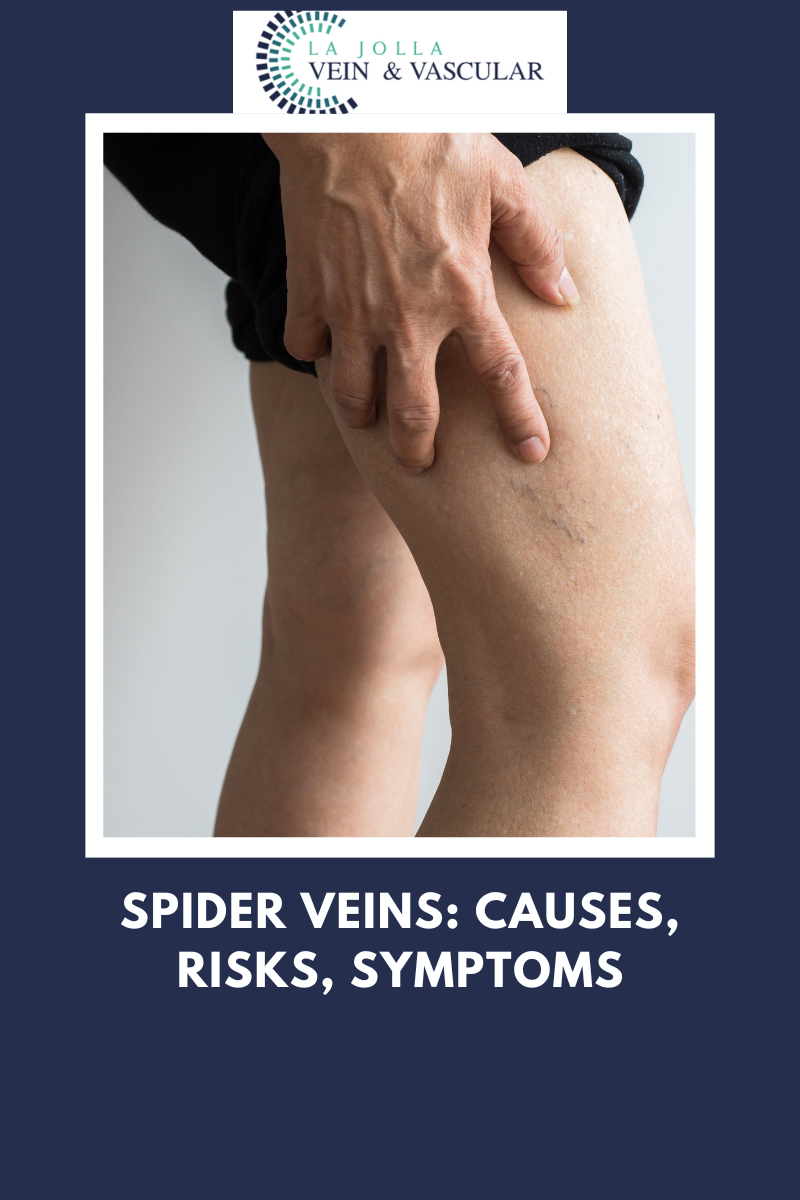 What Causes Dark Spots on Your Legs and How Treat Them? - Downtown Vein &  Vascular