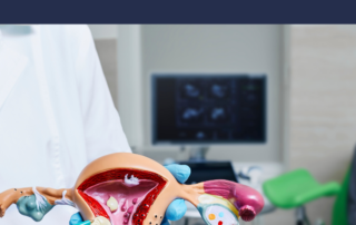 uterine fibroids