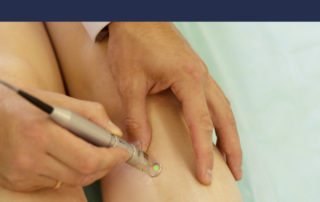 endovenous