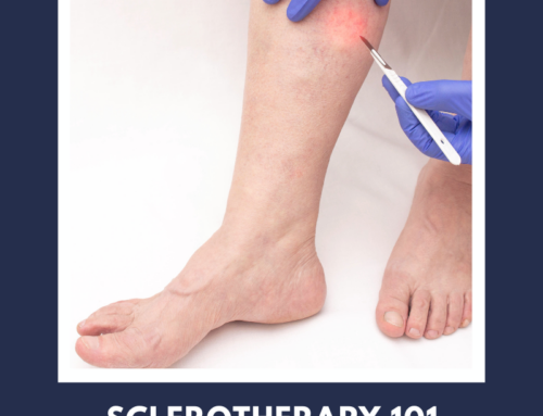 Sclerotherapy 101