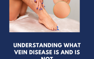 vein disease