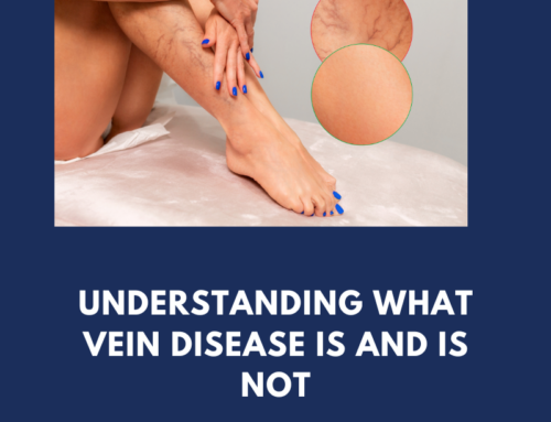Understanding what vein disease is and is not