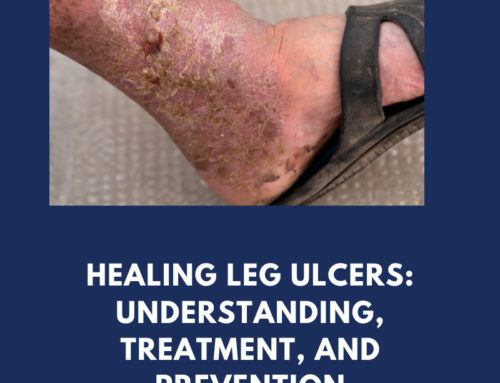 Healing leg ulcers: understanding, treatment, and prevention strategies
