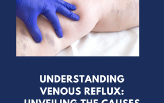 venous reflux
