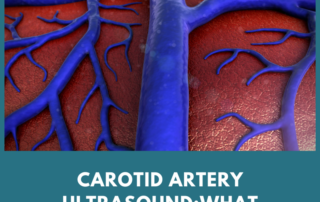 carotid artery
