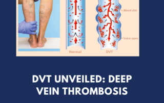 dvt