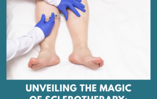sclerotherapy