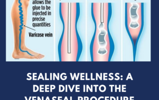 venaseal