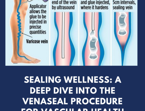 Sealing wellness: A deep dive into the Venaseal procedure for vascular health