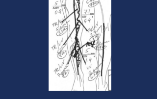 vein mapping