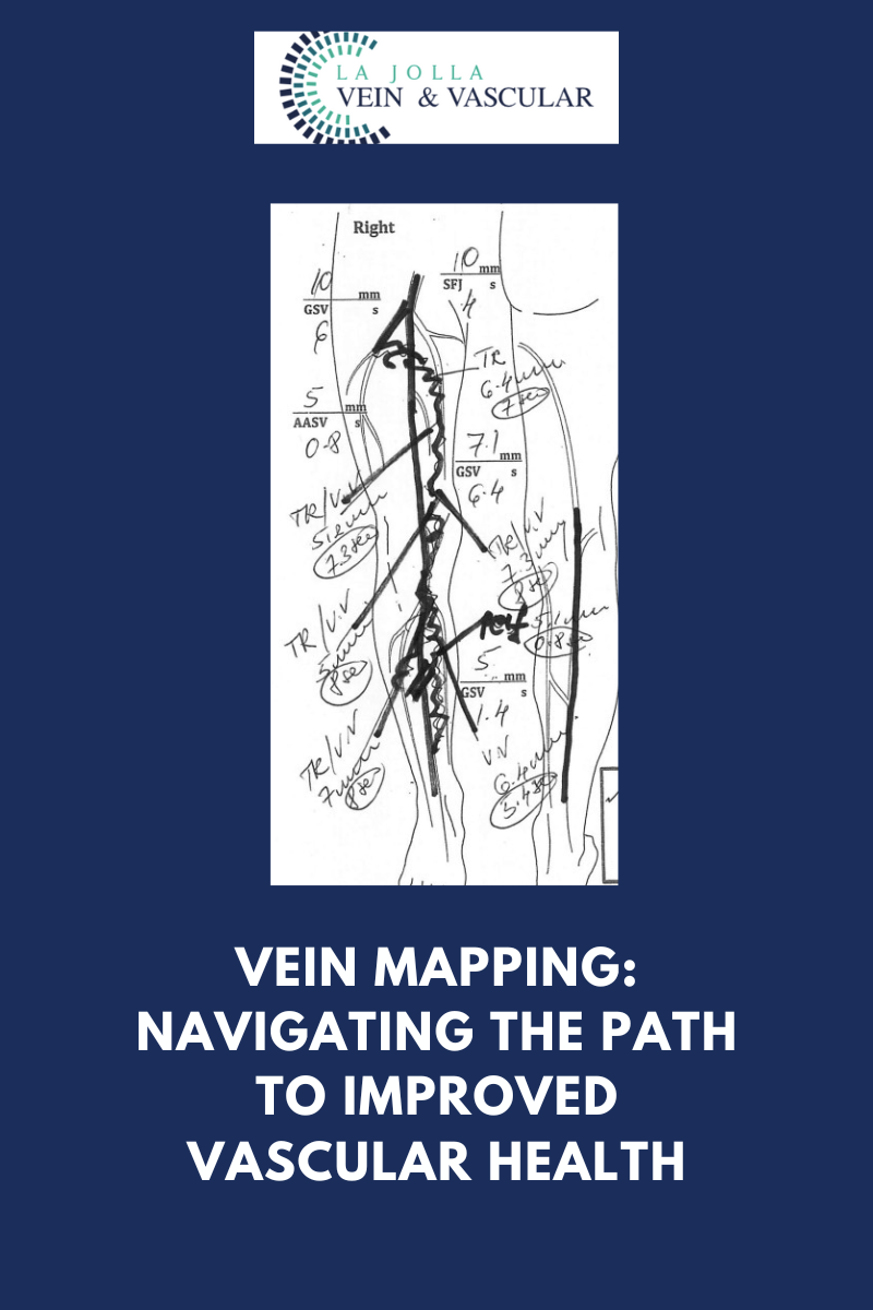vein mapping