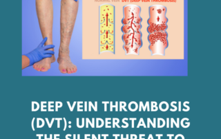 Deep Vein Thrombosis (DVT) - Silent Threat to Vascular Health