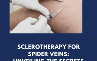 Unveiling the Secrets to Flawless Legs | Sclerotherapy Procedure