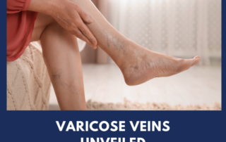 Varicose Veins 101: Causes, Symptoms & Relief Options