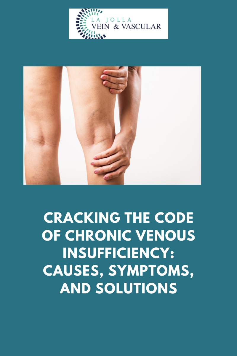 Venous insufficiency Information