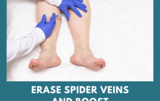 sclerotherapy