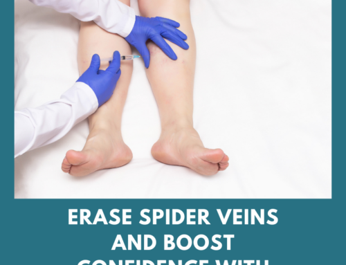 Erase Spider Veins and Boost Confidence with Cosmetic Sclerotherapy