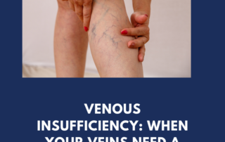 Venous Insufficiency Treatment | Vein & Vascular Care