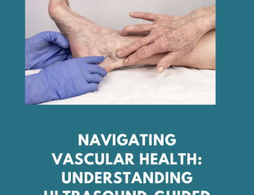 Navigating Vascular Health: Understanding Ultrasound-Guided Foam Sclerotherapy