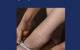 Effective Swelling Treatments: Managing Lymphedema