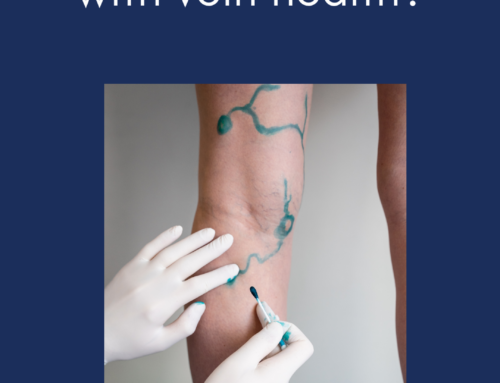 How does ClariVein® help with vein health?