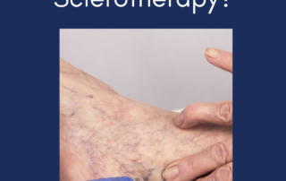 What can I expect from Ultrasound-Guided Foam Sclerotherapy?