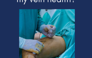 Perforator Vein Treatment - Options, Tips & Suggestions