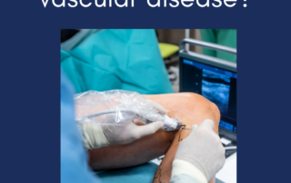 Radiofrequency Ablation Treatment | Vein & Vascular Clinic