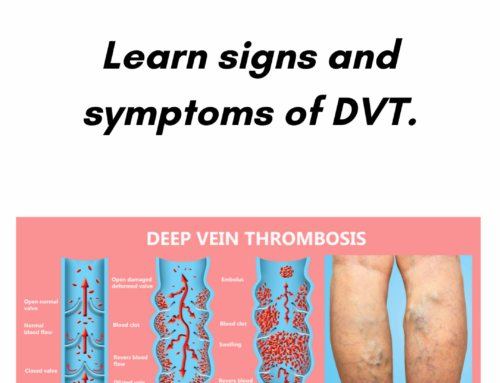 Could I have a DVT? Learn signs and symptoms of Deep Vein Thrombosis