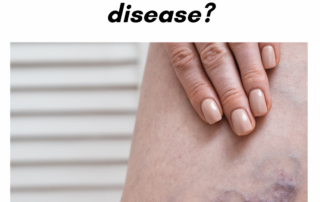 What Do I Need to Know About Venous Disease? [2024]