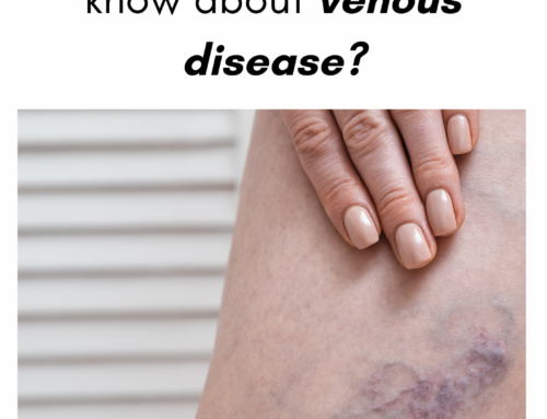 What do I need to know about venous disease?
