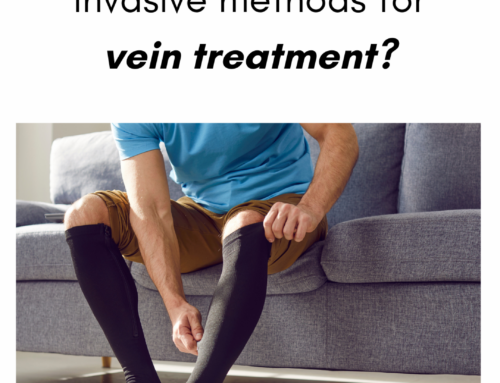 Are there non invasive methods for vein treatment?
