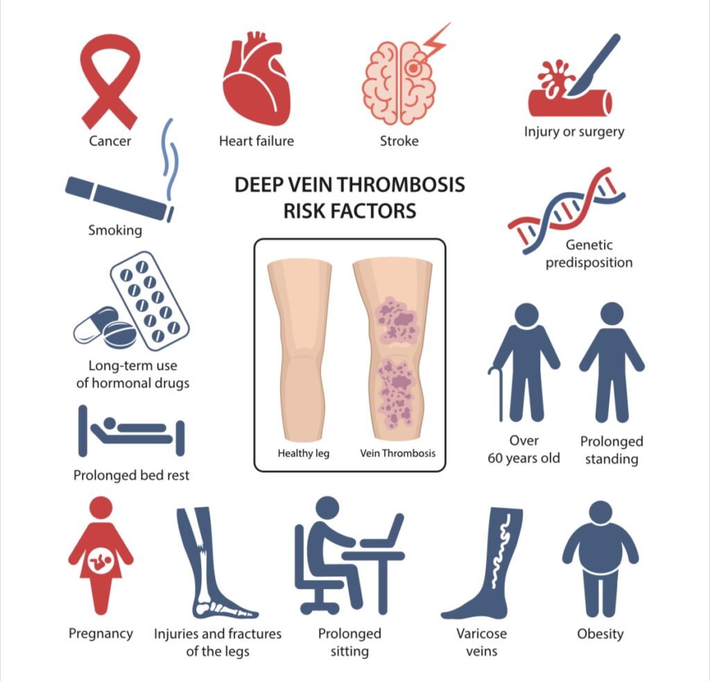 The Hidden Danger Of Icds Understanding Dvt Risk - congg1y