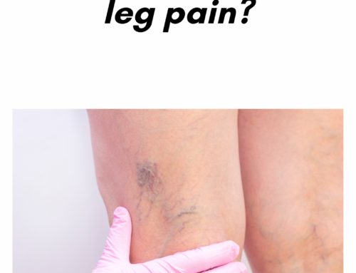 Why do I have leg pain?