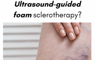 sclerotherapy