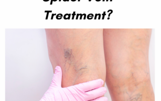 spider vein