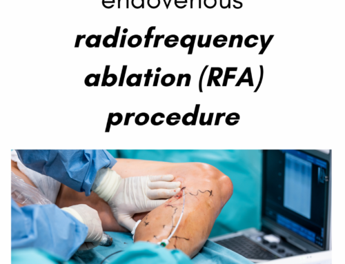 Patient guide for an endovenous radiofrequency ablation (RFA) procedure