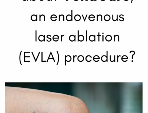 What should I know about VenaCure, an endovenous laser ablation (EVLA) procedure?
