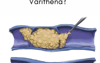 varithena