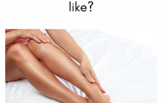 What Does Spider Vein Removal Look Like? – La Jolla Vein Care