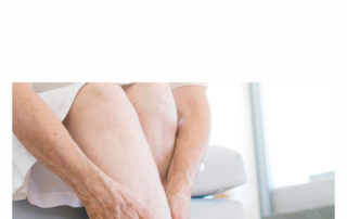 Cryosclerotherapy | Is Cryo Sclerotherapy Painful? - La Jolla Vein & Vascular