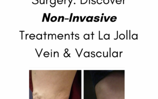 non invasive